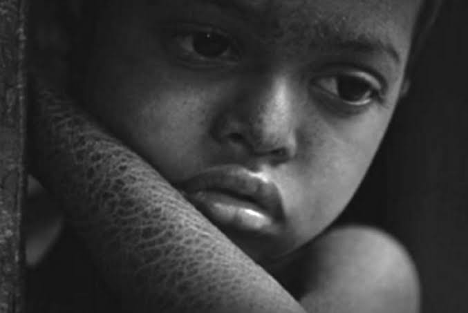 RELIEF FOR ENDOSULFAN VICTIMS